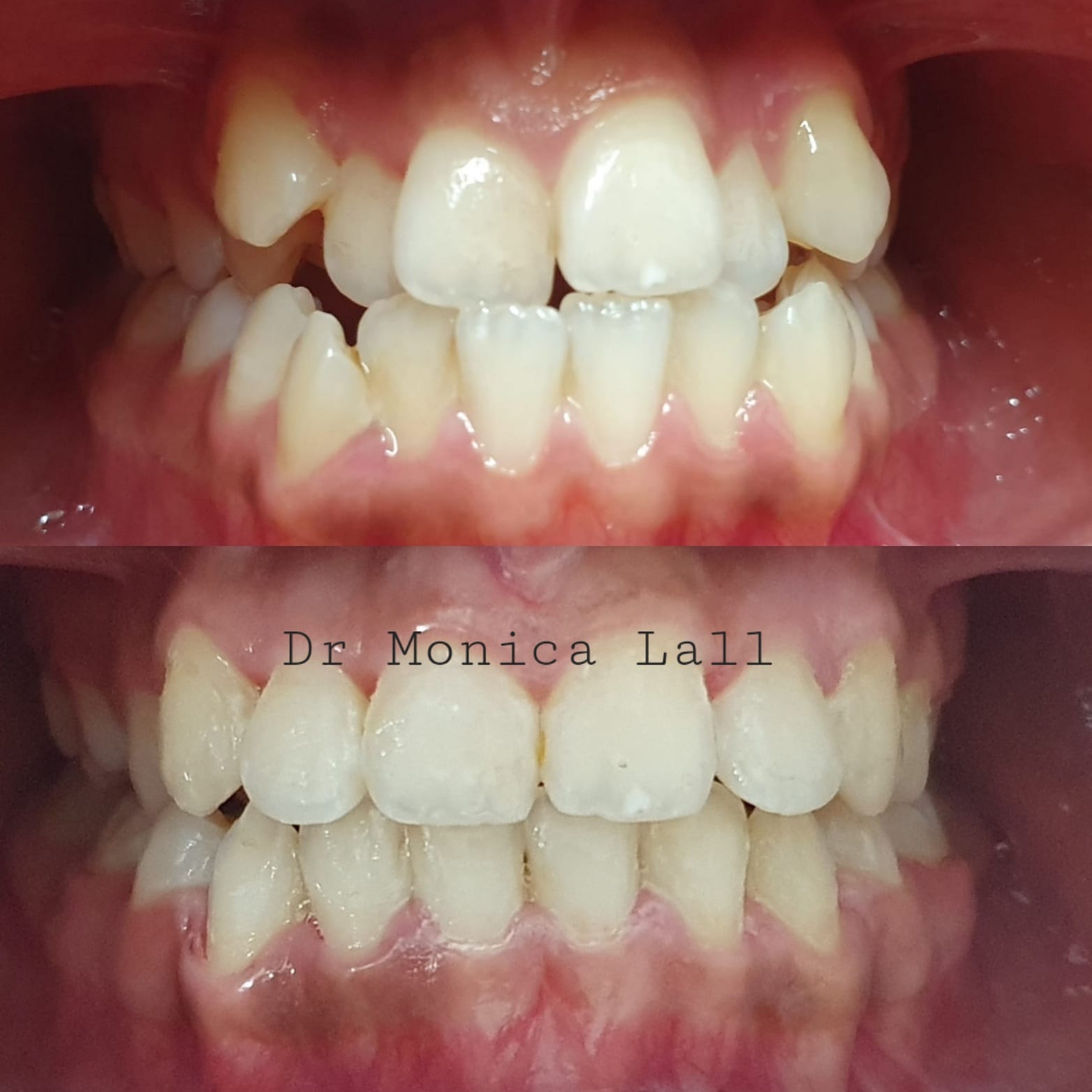 Dental Transformation